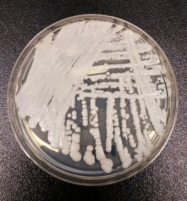 Candida auris на шкірі: як небезпечний грибок уникає імунітету