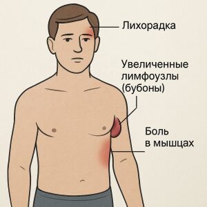 чума