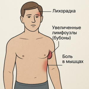 чума