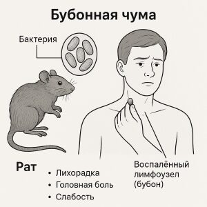 чума