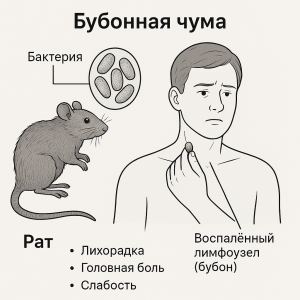 чума